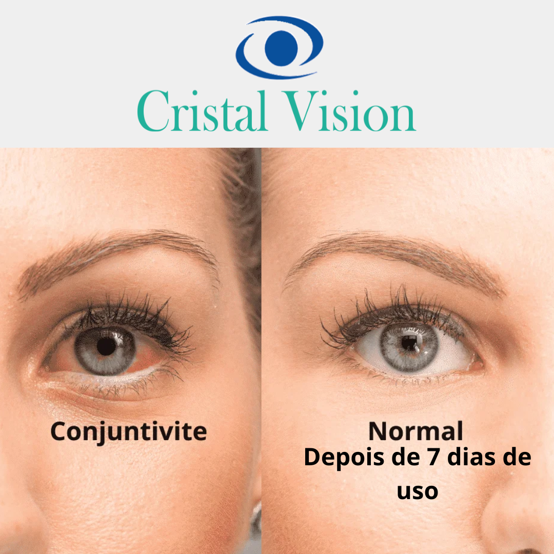 BASE ANTES E DEPOIS (2)