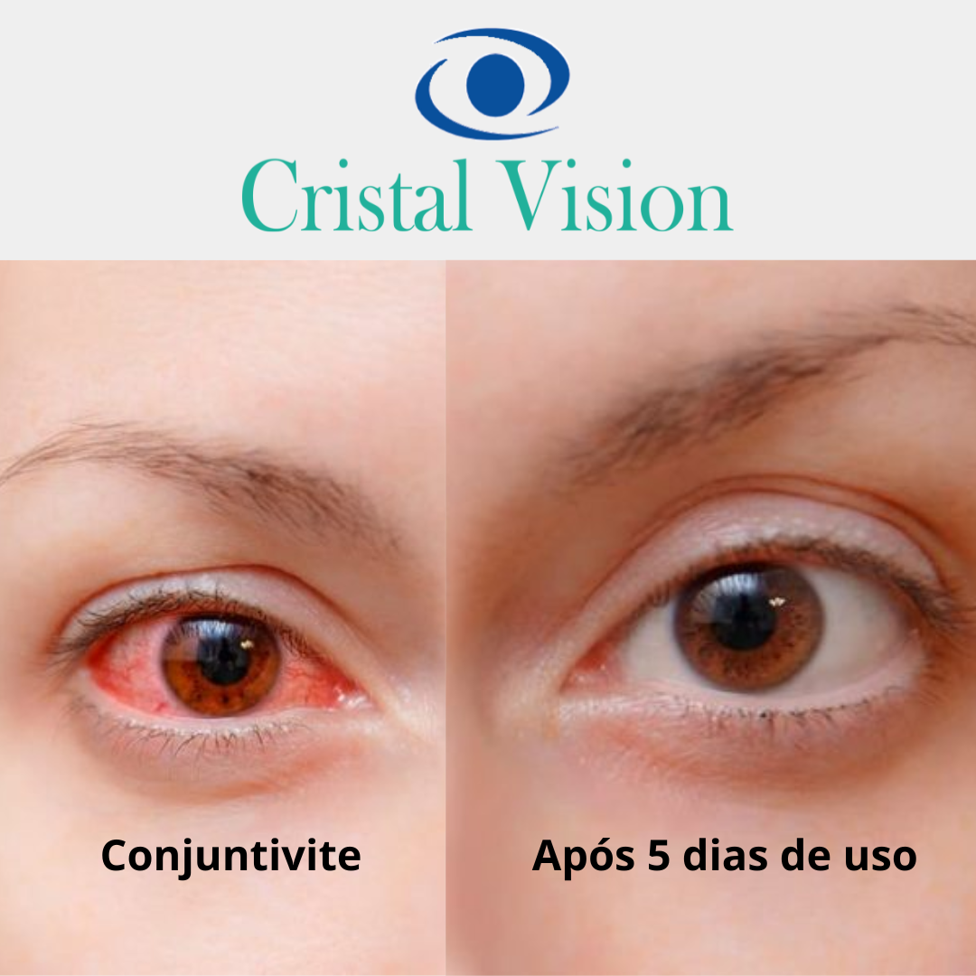 BASE ANTES E DEPOIS (3)